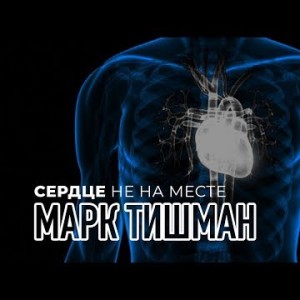 Марк Тишман - Сердце не на месте